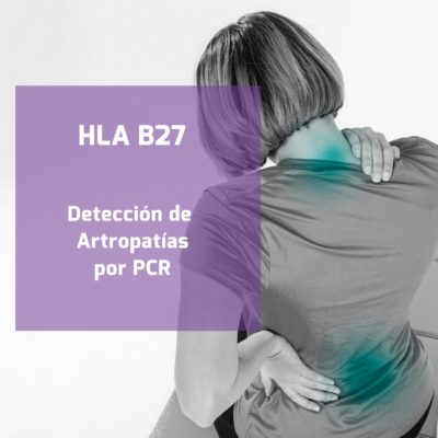 HLA B27 POR PCR